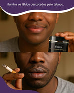 Load image into Gallery viewer, Yoxier™ | Sérum branqueador para lábios escuros ou danificados pelo tabaco (Satisfação garantida ou o seu dinheiro de volta)